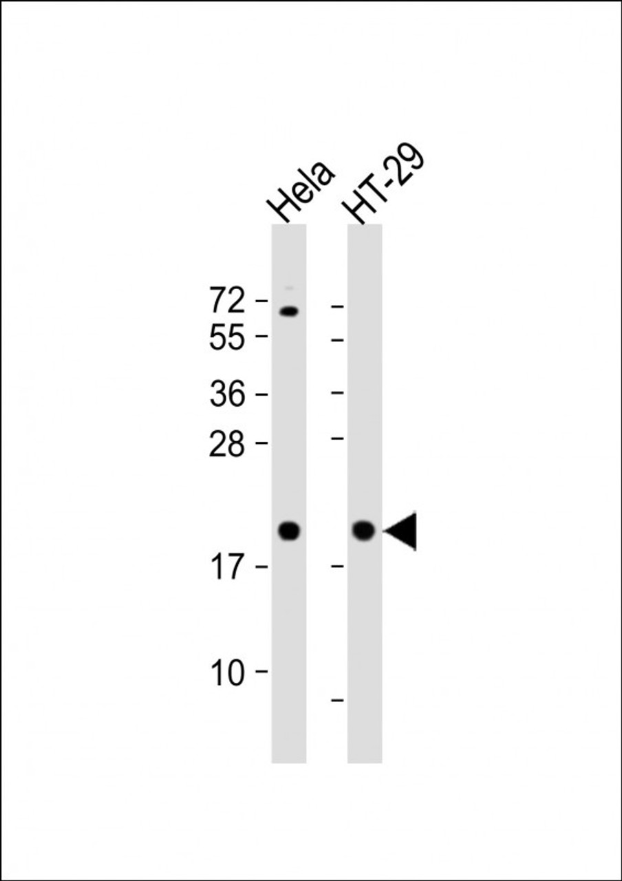 Western Blot at 1:1000 dilution Lane 1: Hela whole cell lysate Lane 2: HT-29 whole cell lysate Lysates/proteins at 20 ug per lane.