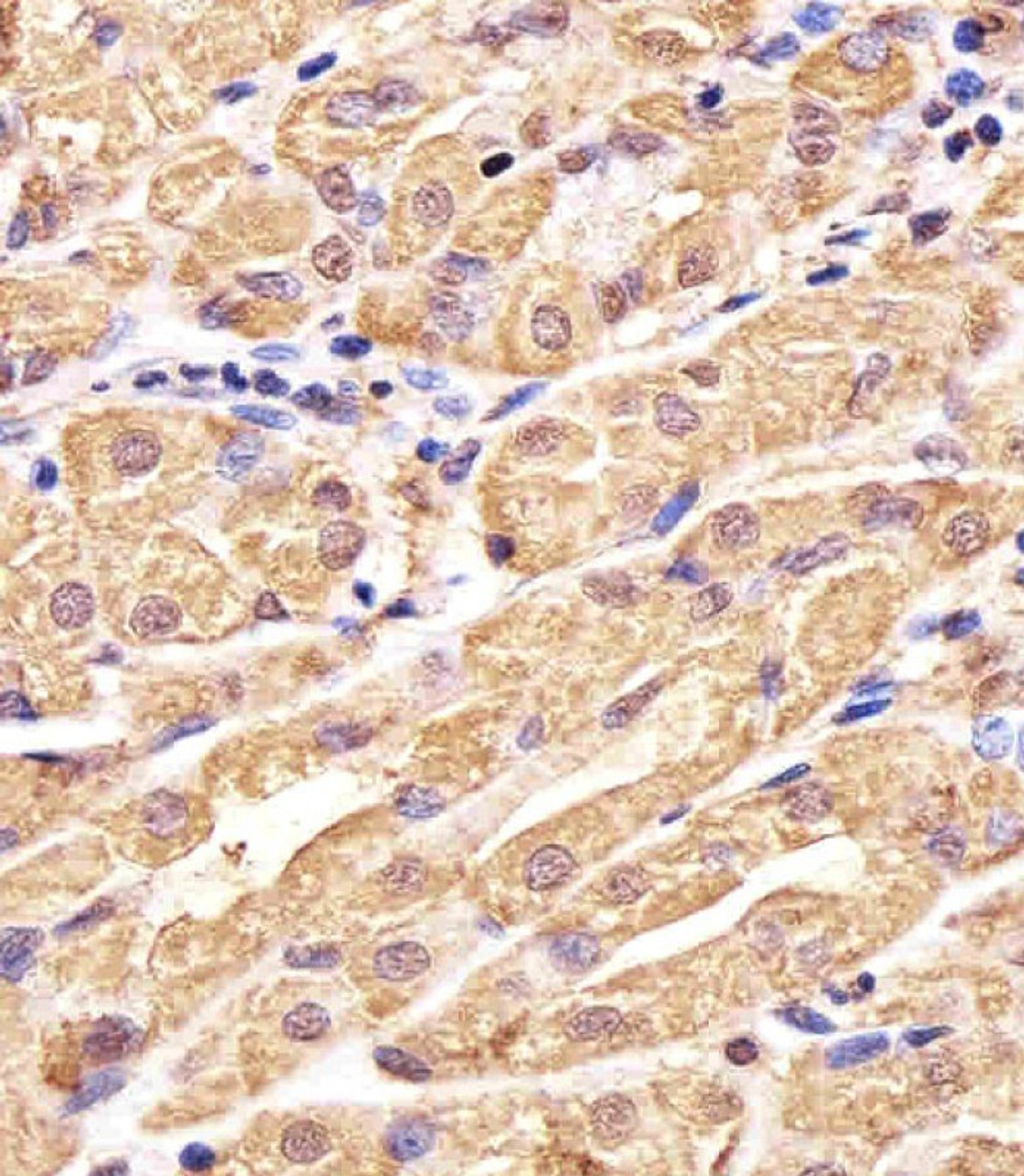 Immunohistochemical analysis of paraffin-embedded H. stomach section using GSS Antibody . Antibody was diluted at 1:25 dilution. A undiluted biotinylated goat polyvalent antibody was used as the secondary, followed by DAB staining.
