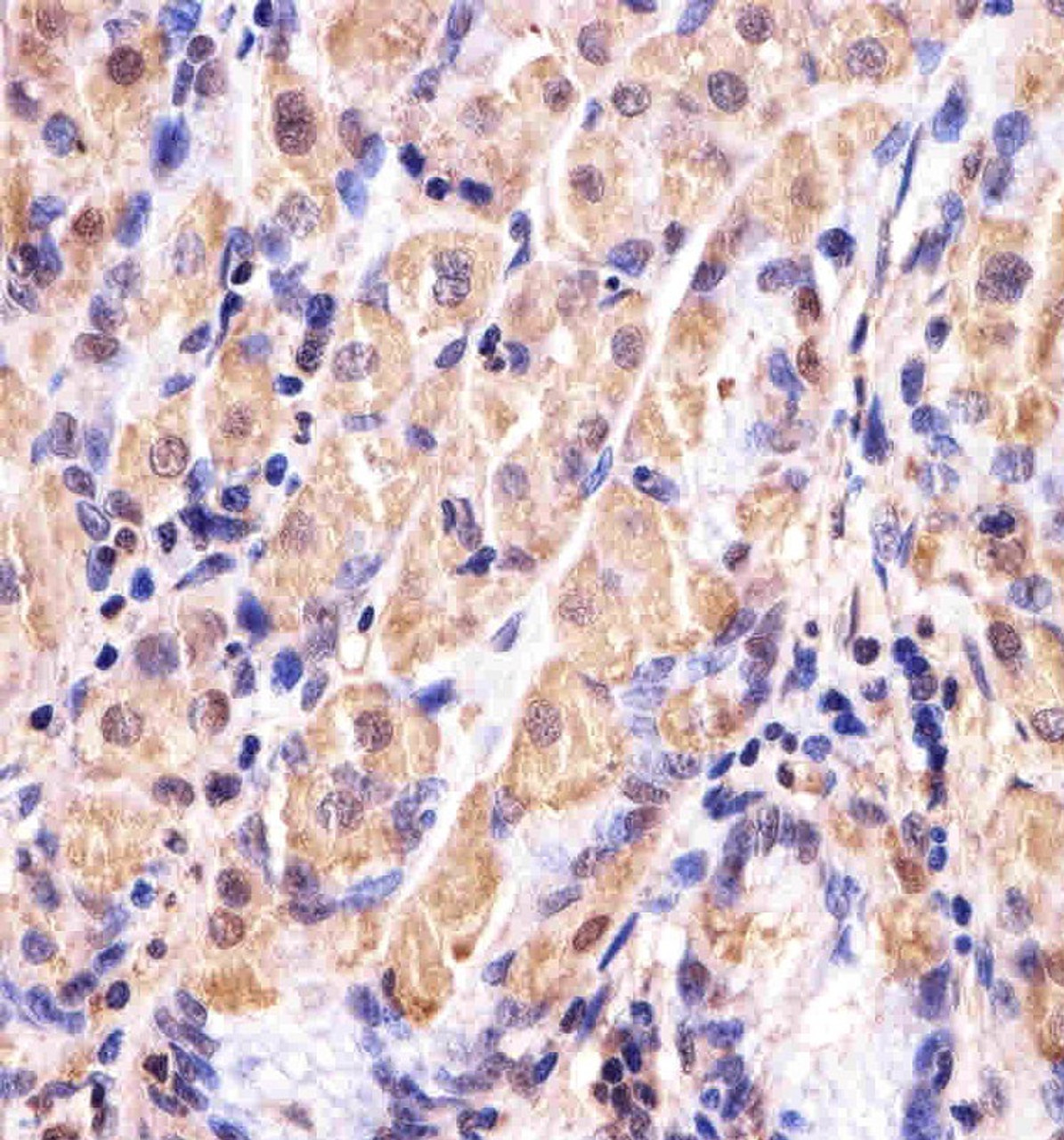 Immunohistochemical analysis of paraffin-embedded H. stomach section using GSS Antibody . Antibody was diluted at 1:25 dilution. A undiluted biotinylated goat polyvalent antibody was used as the secondary, followed by DAB staining.