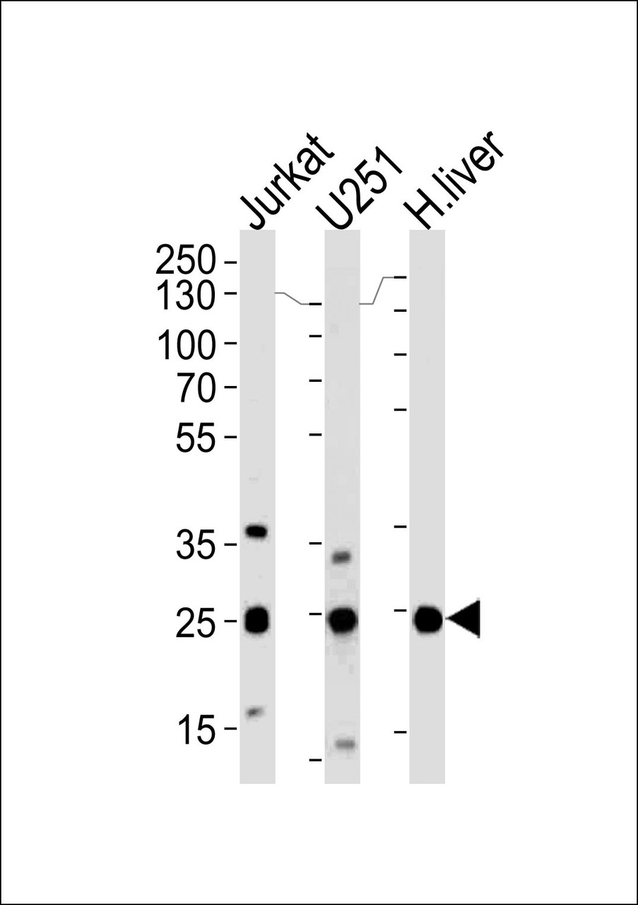 Western blot analysis of lysates from Jurkat, U251 cell line and human liver tissue (from left to right) , using GSTM1 Antibody at 1:1000 at each lane.