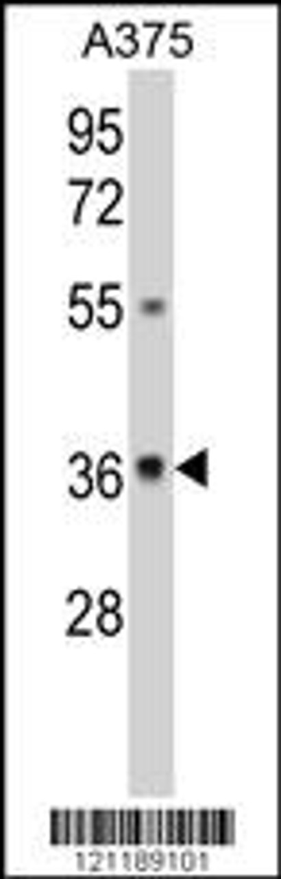 Western blot analysis of GALE Antibody in A375 cell line lysates (35ug/lane)