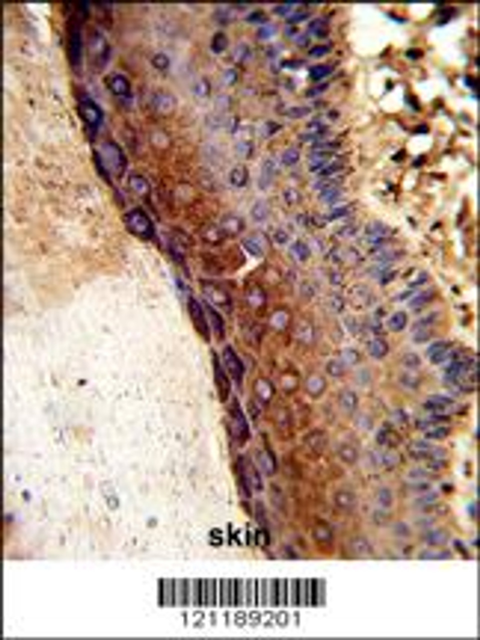 Formalin-fixed and paraffin-embedded human skin tissue reacted with GALE Antibody, which was peroxidase-conjugated to the secondary antibody, followed by DAB staining.