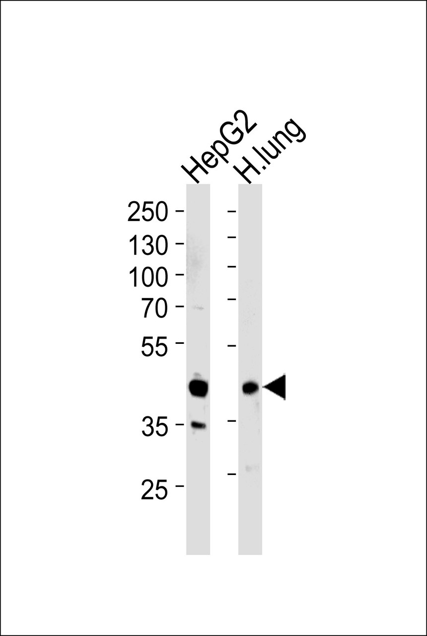 Western blot analysis of lysates from HepG2 cell line and human lung tissue lysates (from left to right) , using RAGE Antibody at 1:1000 at each lane.