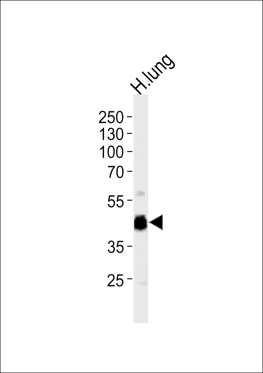 Western blot analysis of lysate from human lung tissue lysate, using RAGE Antibody at 1:1000 at each lane.