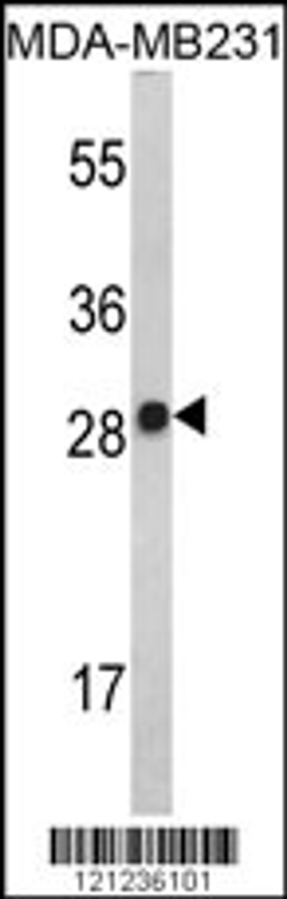 Western blot analysis of IL2 Antibody in MDA-MB231 cell line lysates (35ug/lane)