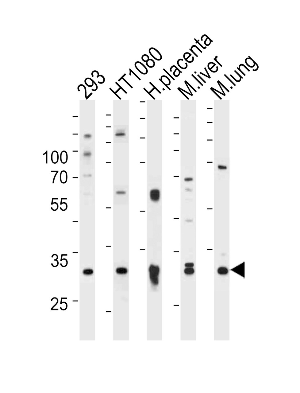 Western blot analysis of lysates from 293, HT1080 cell line, human placenta, mouse liver and lung tissue (from left to right) , using SAR1A Antibody .AP6915c was diluted at 1:1000 at each lane.