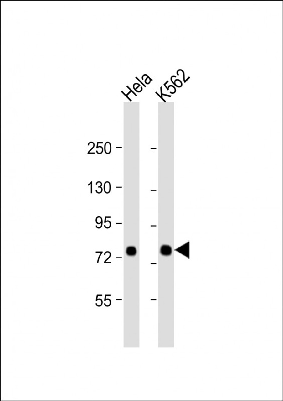 Western Blot at 1:1000 dilution Lane 1: Hela whole cell lysate Lane 2: K562 whole cell lysate Lysates/proteins at 20 ug per lane.