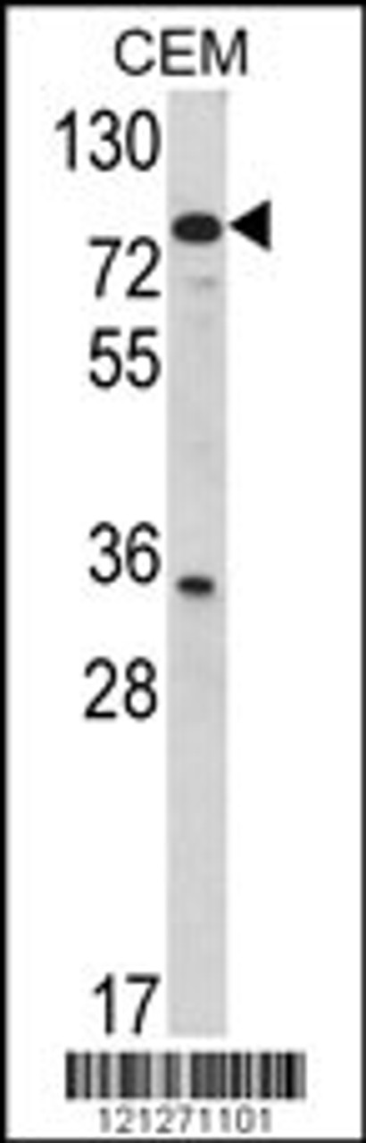 Western blot analysis of TGM4 Antibody in CEM cell line lysates (35ug/lane)