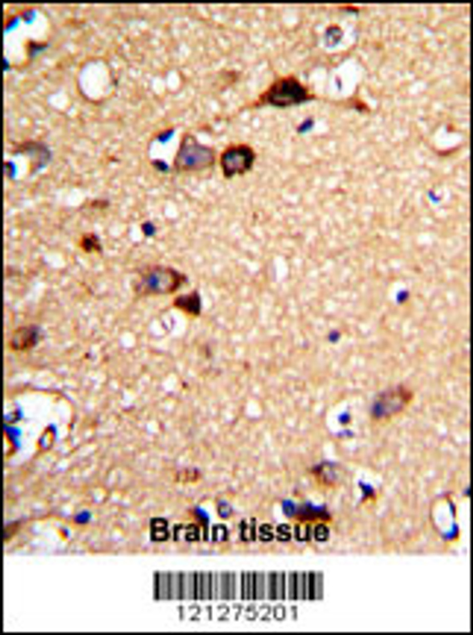 Formalin-fixed and paraffin-embedded human brain tissue with UNC5C Antibody, which was peroxidase-conjugated to the secondary antibody, followed by DAB staining.