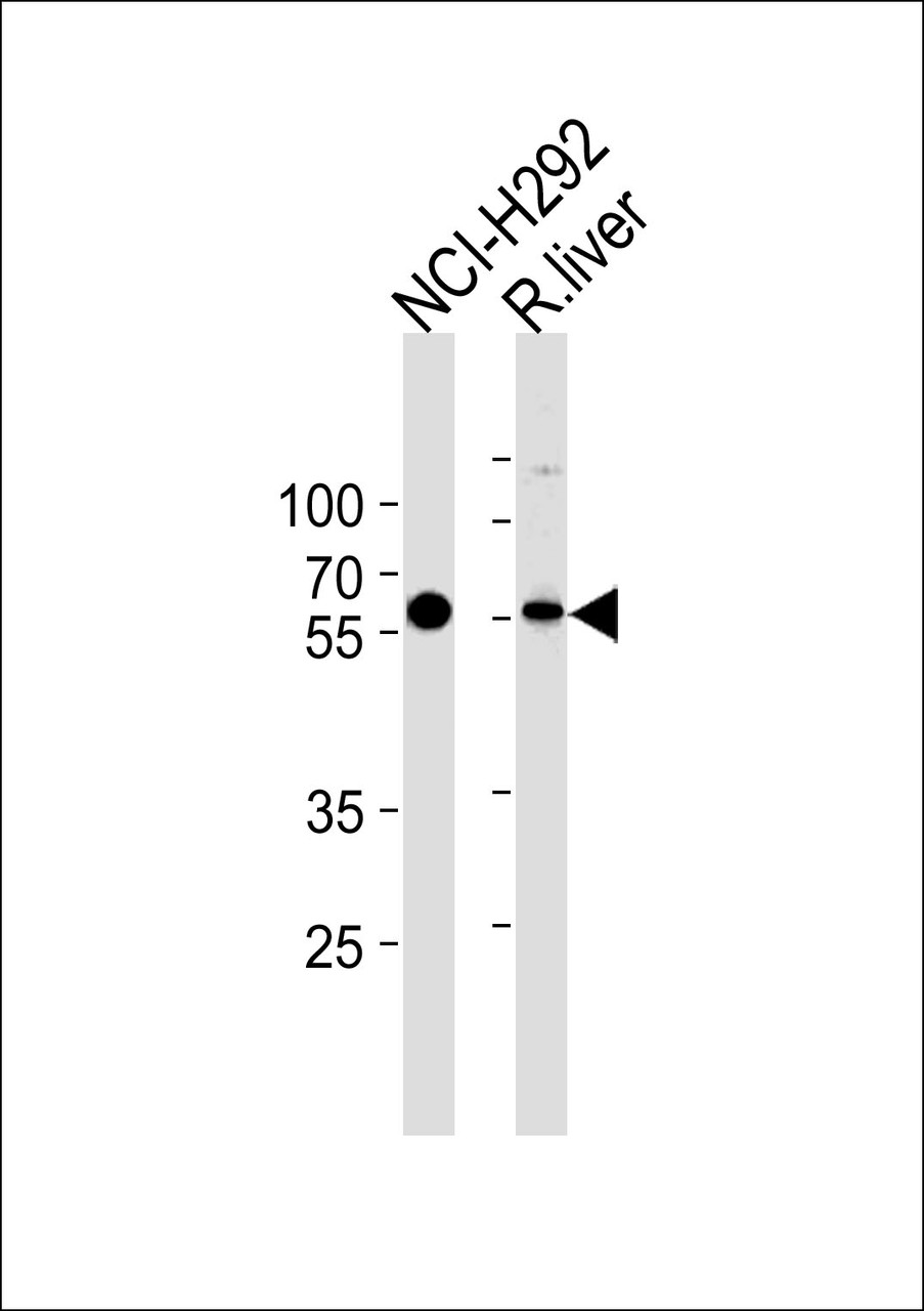 Western blot analysis in NCI-H292 cell line and rat liver tissue lysates (35ug/lane) .