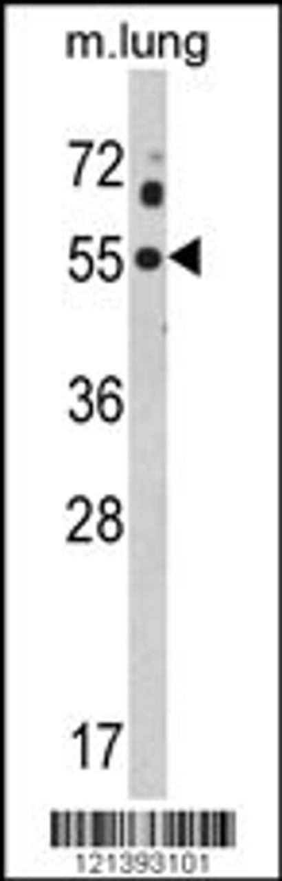 Western blot analysis of KCNJ2 Antibody in mouse lung tissue lysates (35ug/lane)