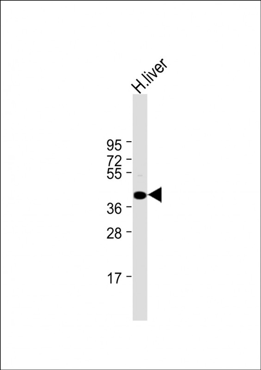 Western Blot at 1:1000 dilution + human liver lysate Lysates/proteins at 20 ug per lane.