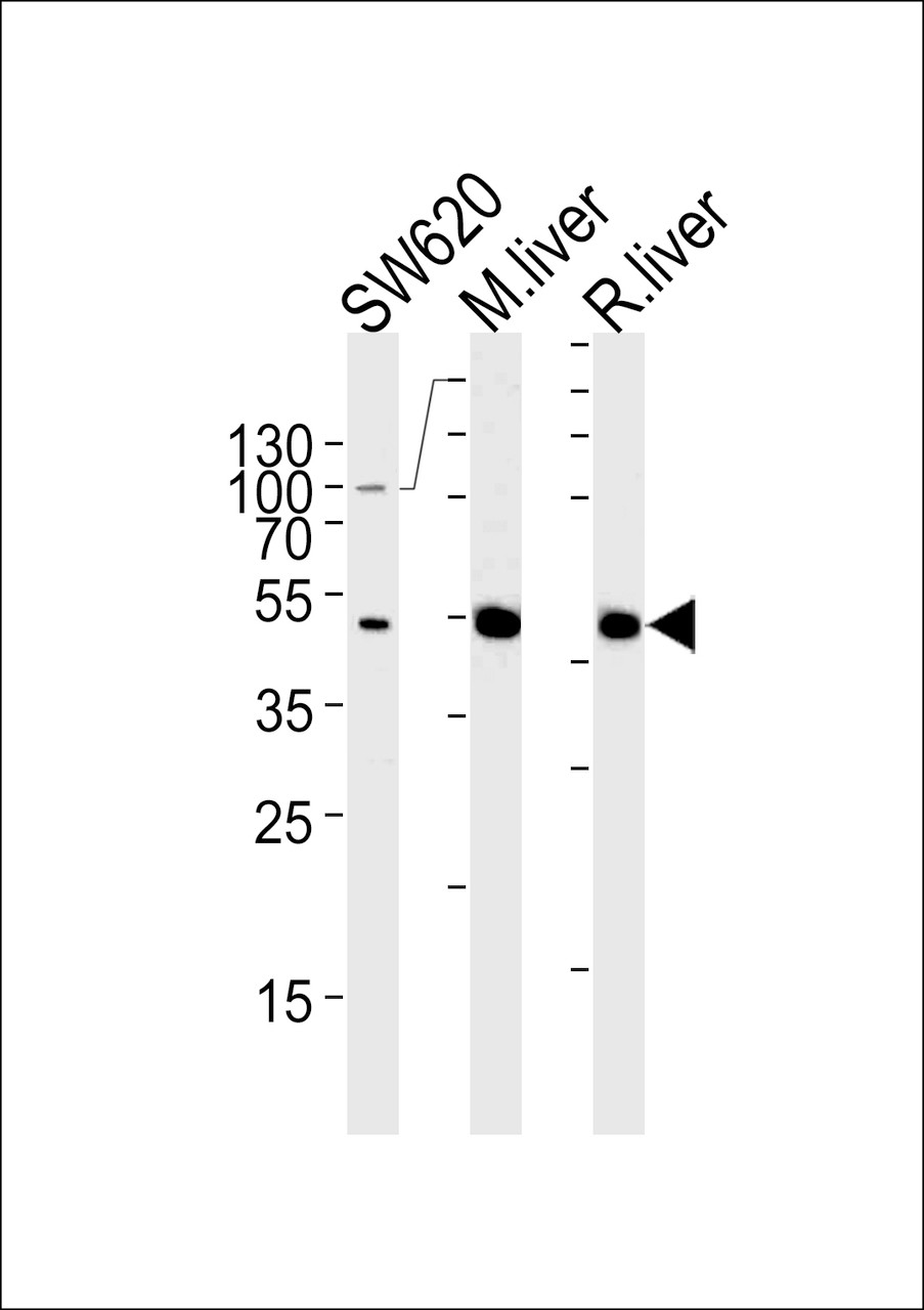 Western blot analysis in SW620 cell line and mouse liver，rat liver lysates (35ug/lane) .