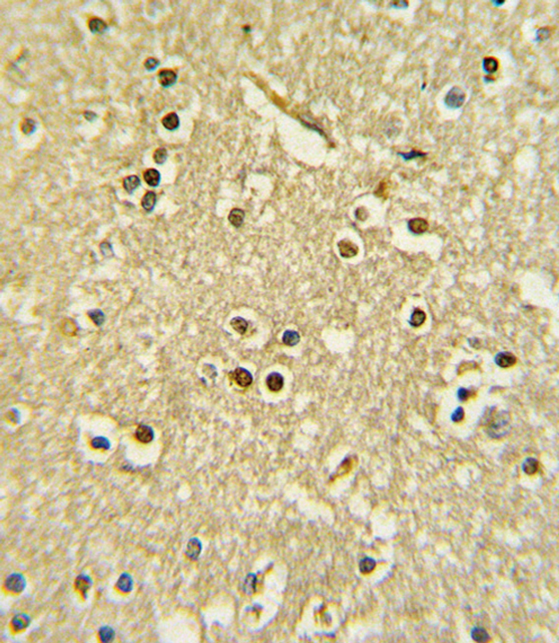 Formalin-fixed and paraffin-embedded human brain tissue with PAX6 Antibody, which was peroxidase-conjugated to the secondary antibody, followed by DAB staining.