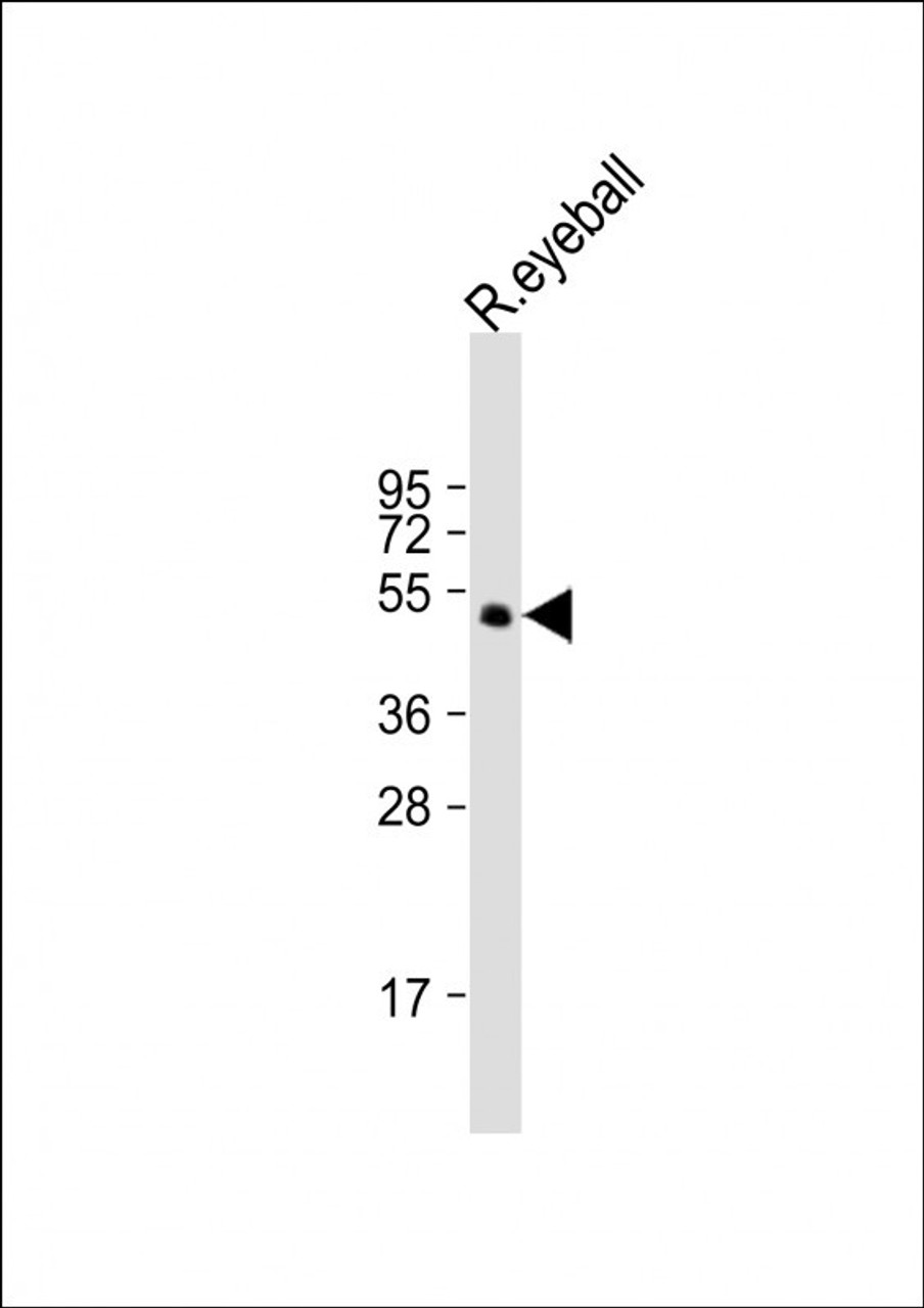 Western Blot at 1:2000 dilution + rat eyeball lysate Lysates/proteins at 20 ug per lane.