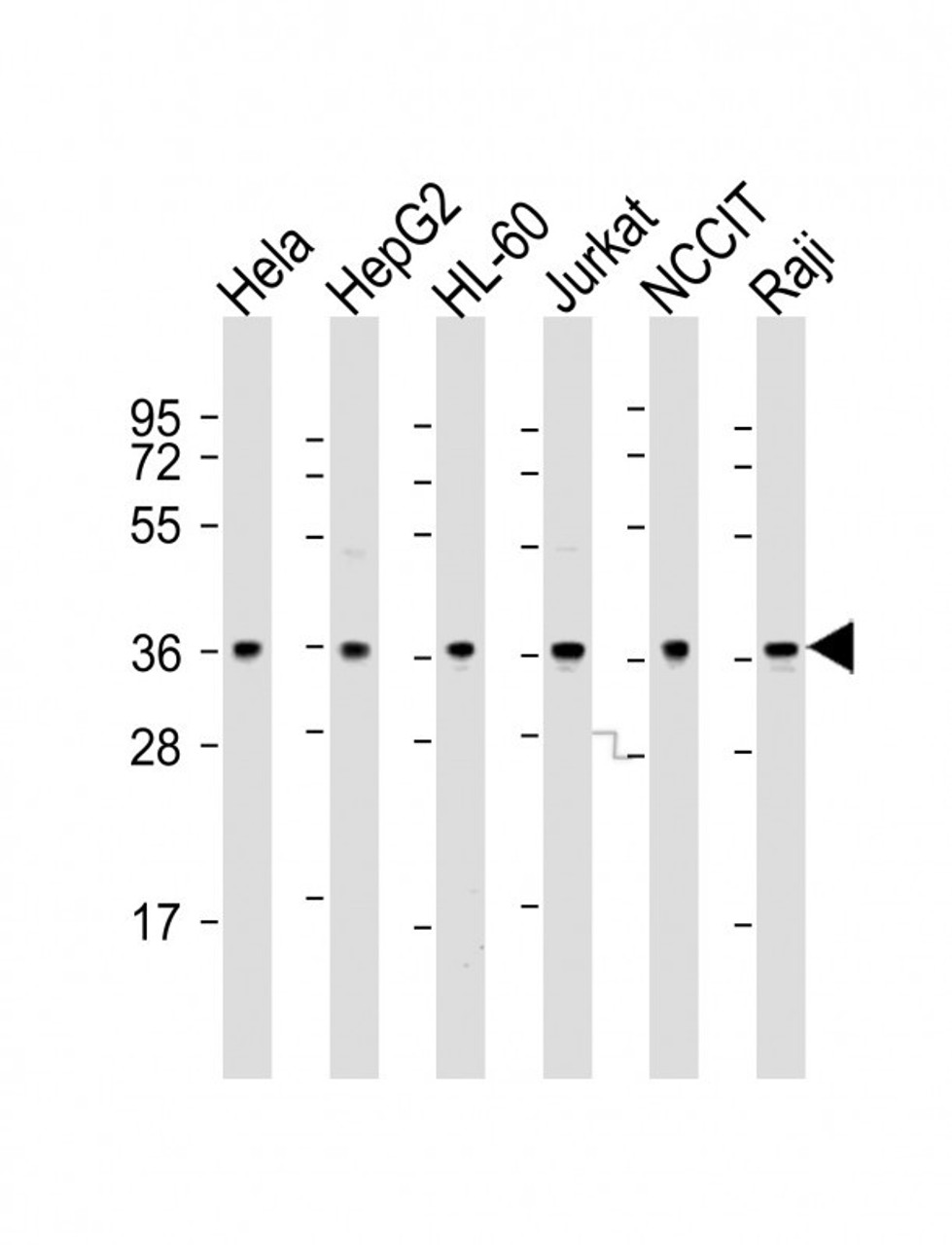 Western Blot at 1:2000 dilution Lane 1: Hela whole cell lysate Lane 2: HepG2 whole cell lysate Lane 3: HL-60 whole cell lysate Lane 4: Jurkat whole cell lysate Lane 5: NCCIT whole cell lysate Lane 6: Raji whole cell lysate Lysates/proteins at 20 ug per lane.