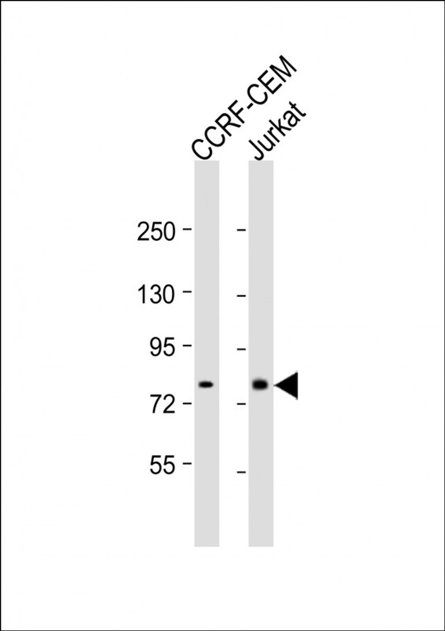Western Blot at 1:1000 dilution Lane 1: CCRF-CEM whole cell lysate Lane 2: Jurkat whole cell lysate Lysates/proteins at 20 ug per lane.