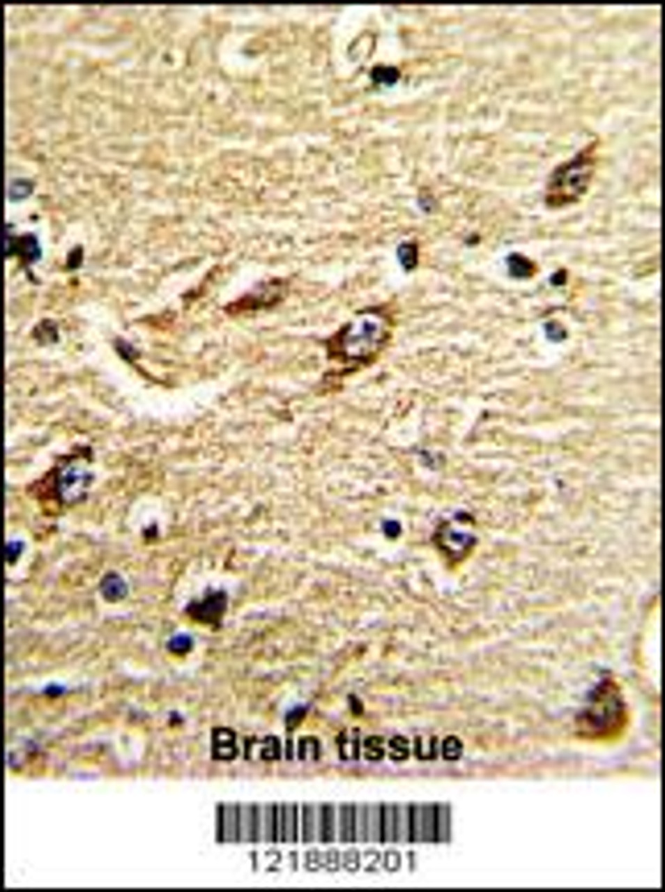 Formalin-fixed and paraffin-embedded human brain tissue reacted with ND5 Antibody, which was peroxidase-conjugated to the secondary antibody, followed by DAB staining.