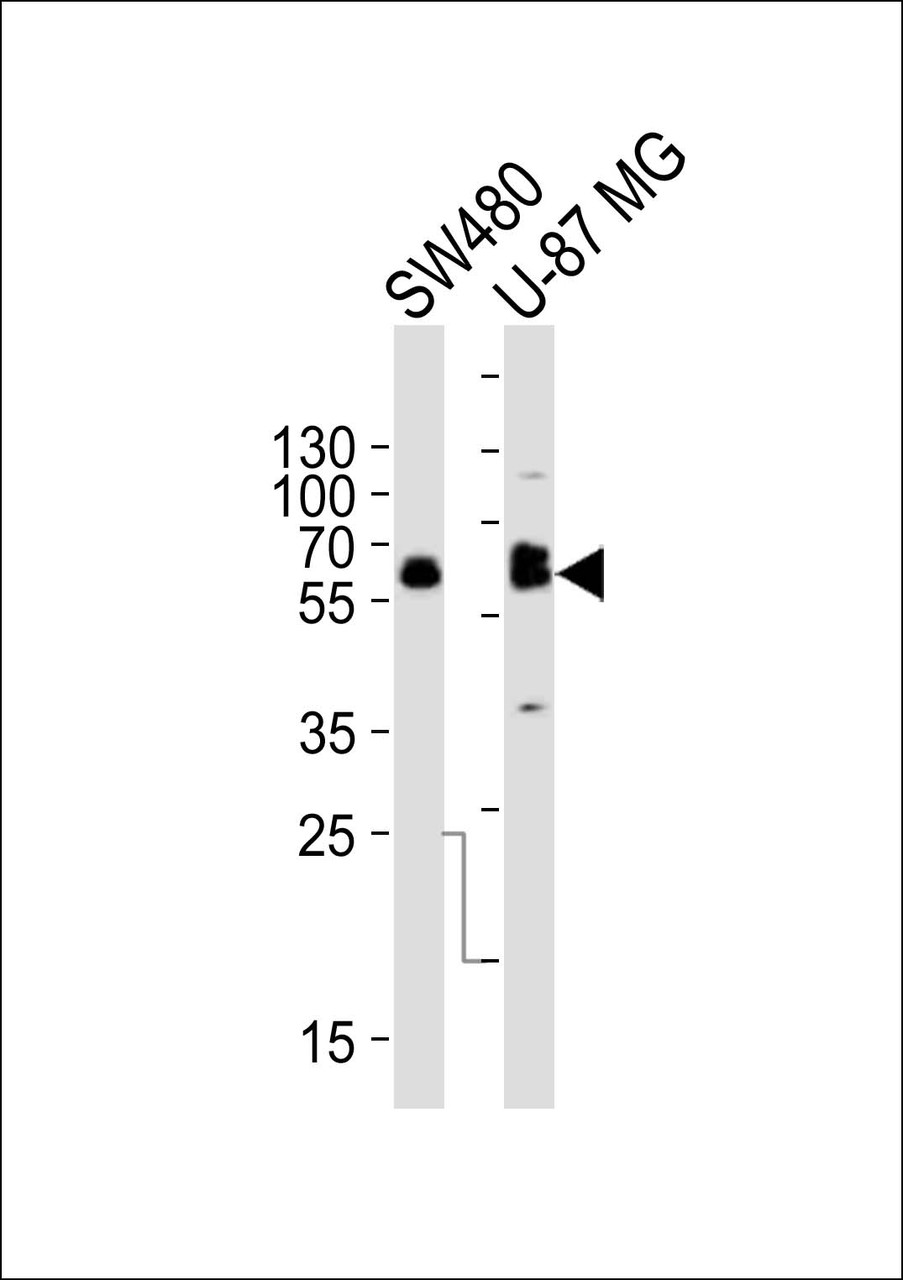 Western blot analysis of lysates from SW480, U-87 MG cell line (from left to right) , using TH Antibody at 1:1000 at each lane.