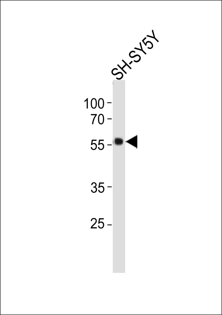 Western blot analysis in SH-SY5Y cell line lysates (35ug/lane) .This demonstrates the detected the TH protein (arrow) .