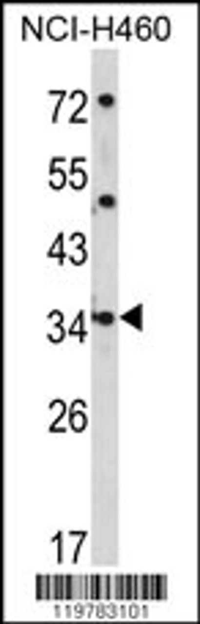 Western blot analysis of CER1 Antibody in NCI-H460 cell line lysates (35ug/lane)