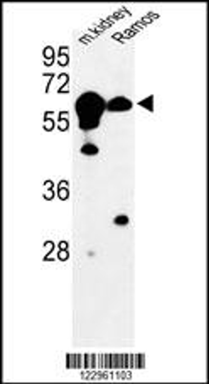 Western blot analysis of CBS Antibody in mouse kidney tissue and Ramos cell line lysates (35ug/lane)