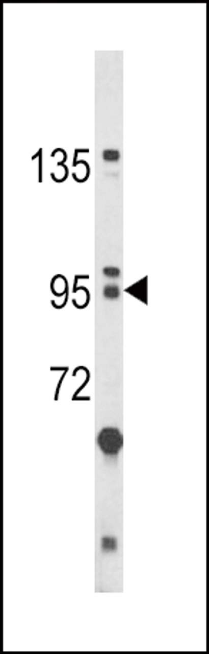 Western blot analysis of BICC1 Antibody in HL-60 cell line lysates (35ug/lane)