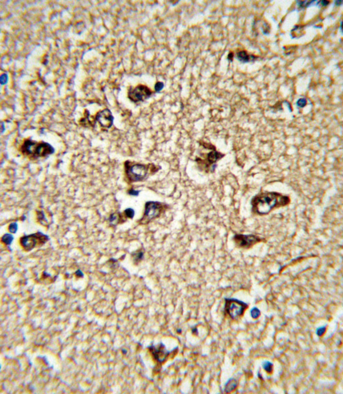 Formalin-fixed and paraffin-embedded human brain tissue reacted with BICC1 Antibody (N-term) , which was peroxidase-conjugated to the secondary antibody, followed by DAB staining.