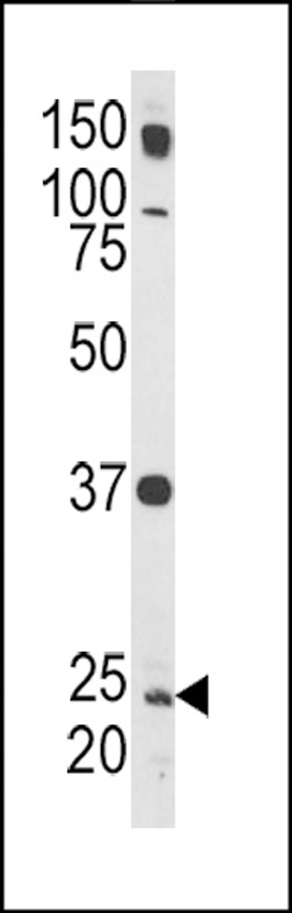 Western blot analysis of Rab5 Antibody in HL-60 cell line lysates (35ug/lane)