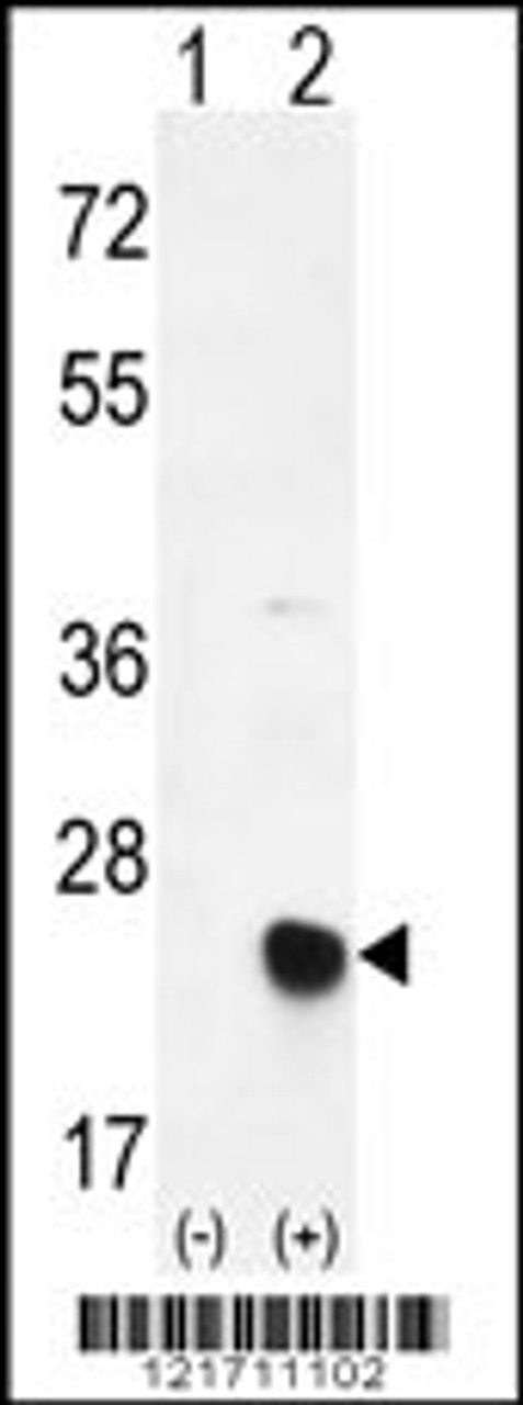 Western blot analysis of MSRB2 using rabbit polyclonal MSRB2 Antibody using 293 cell lysates (2 ug/lane) either nontransfected (Lane 1) or transiently transfected (Lane 2) with the MSRB2 gene.