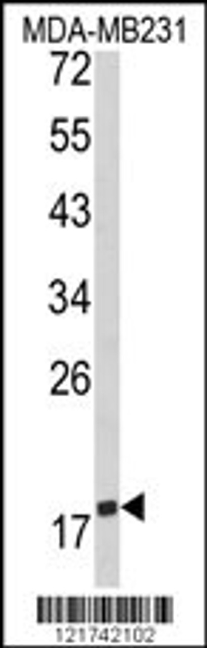 Western blot analysis of CD28 Antibody in MDA-MB231 cell line lysates (35ug/lane)