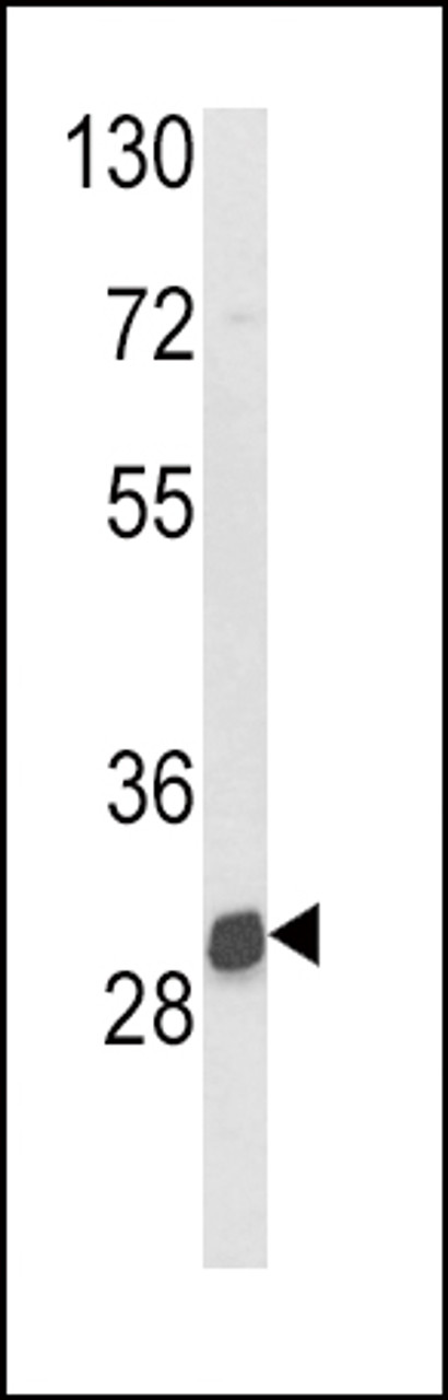 Western blot analysis of NAT2 Antibody in mouse kidney tissue lysates (35ug/lane)