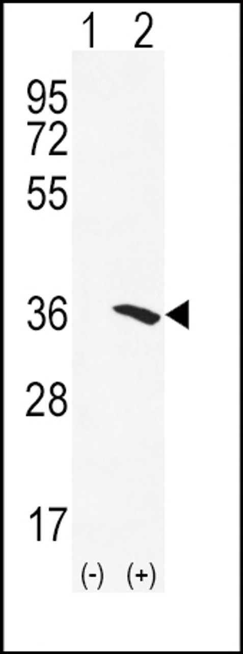 Western blot analysis of NAT2 using rabbit polyclonal NAT2 Antibody using 293 cell lysates (2 ug/lane) either nontransfected (Lane 1) or transiently transfected (Lane 2) with the NAT2 gene.