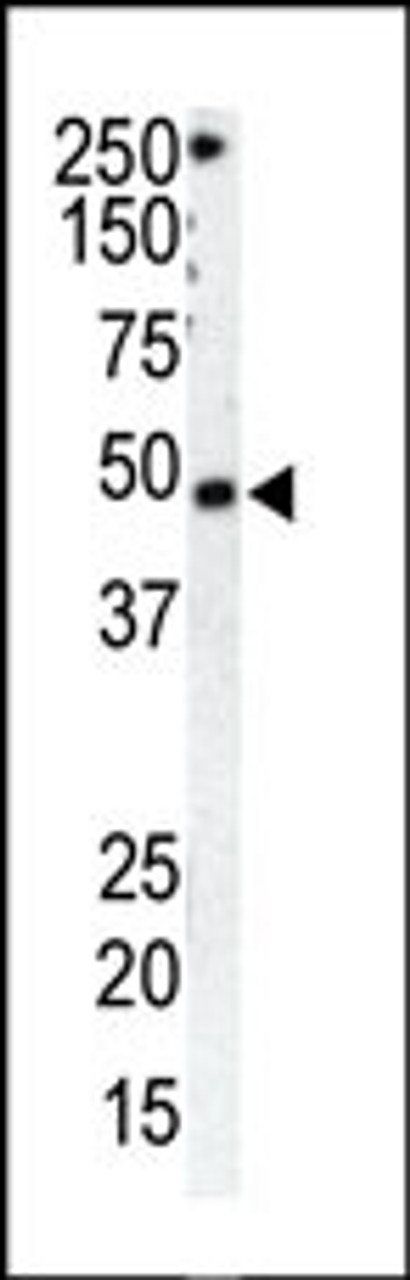 Antibody is used in Western blot to detect GRK1 in HeLa cell lysate (Lane 1) and mouse spleen tissue lysate (Lane 2) .