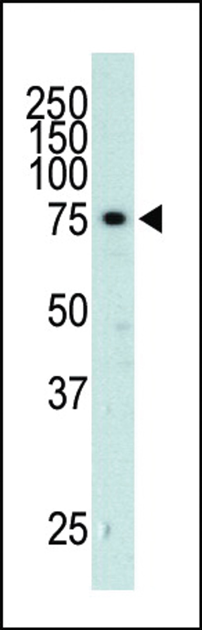 Antibody is used in Western blot to detect GRK3 in mouse heart tissue lysate.