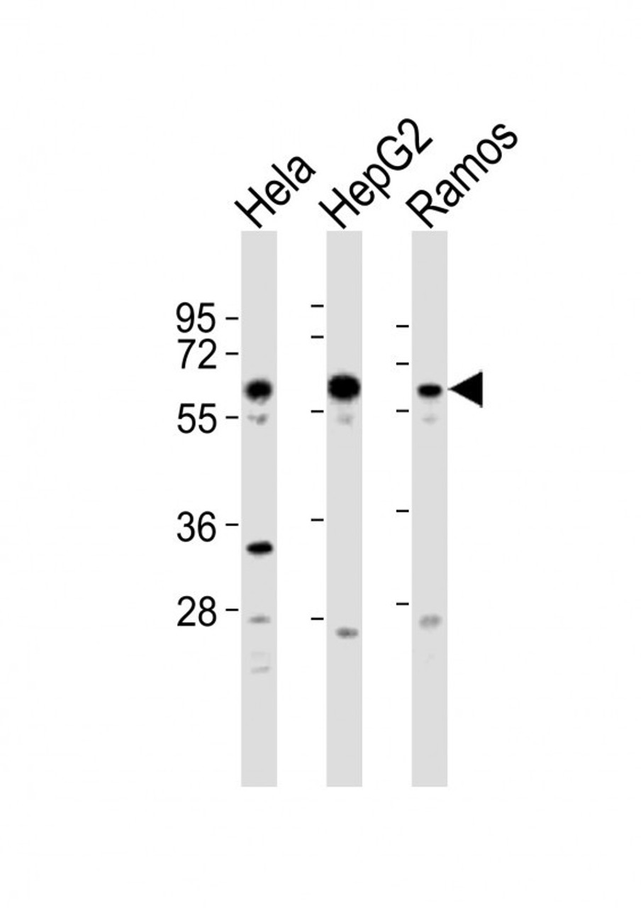 Western Blot at 1:2000 dilution Lane 1: Hela whole cell lysates Lane 2: HepG2 whole cell lysates Lane 3: Ramos whole cell lysates Lysates/proteins at 20 ug per lane.