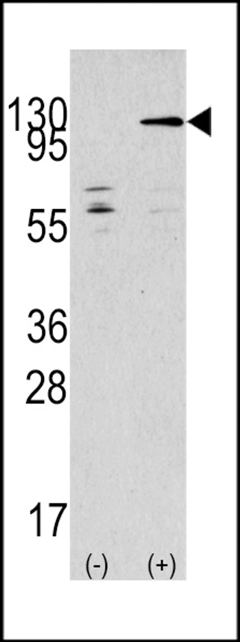 Western blot analysis of TAOK3 using rabbit polyclonal TAOK3 Antibody using 293 cell lysates (2 ug/lane) either nontransfected (Lane 1) or transiently transfected with the TAOK3 gene (Lane 2) .