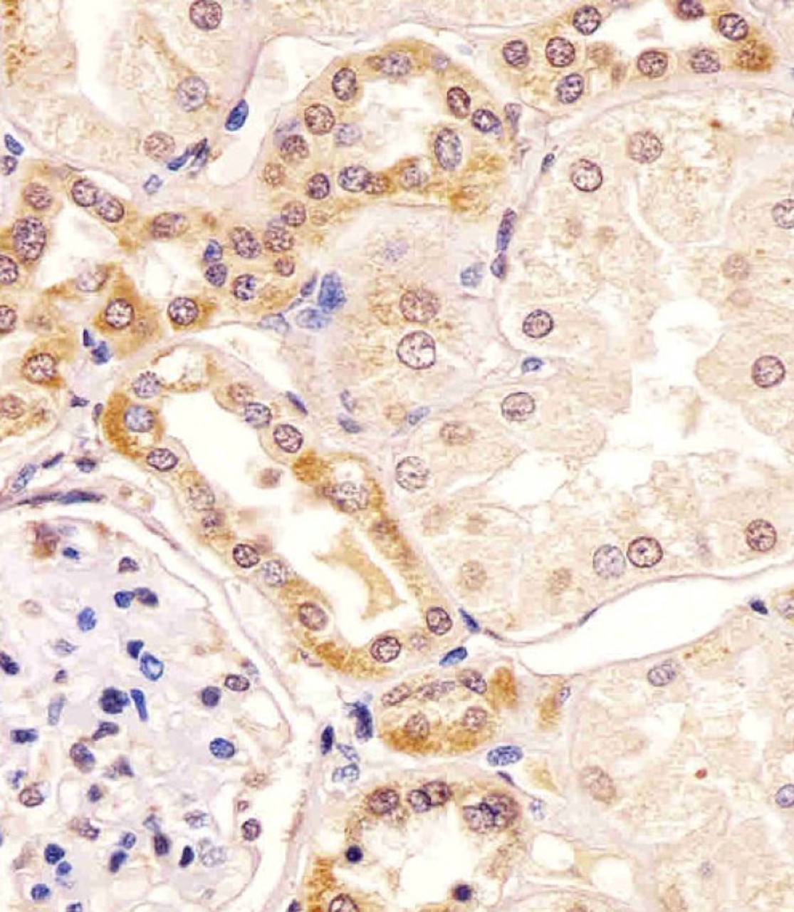 Antibody staining PKC beta1/2 in human kidney tissue sections by Immunohistochemistry (IHC-P - paraformaldehyde-fixed, paraffin-embedded sections) .