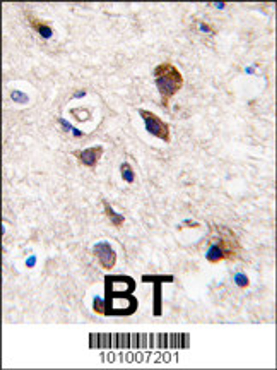 Formalin-fixed and paraffin-embedded human brain tissue reacted with PKC gamma antibody, which was peroxidase-conjugated to the secondary antibody, followed by DAB staining.