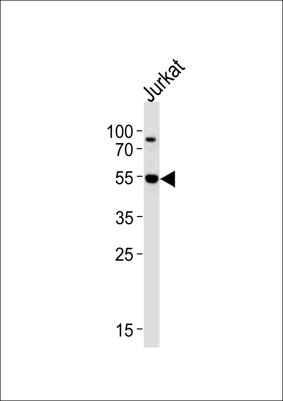Western blot analysis of lysate from Jurkat cell line, using AKT3 Antibody (Q103) .AP7030c was diluted at 1:1000 at each lane