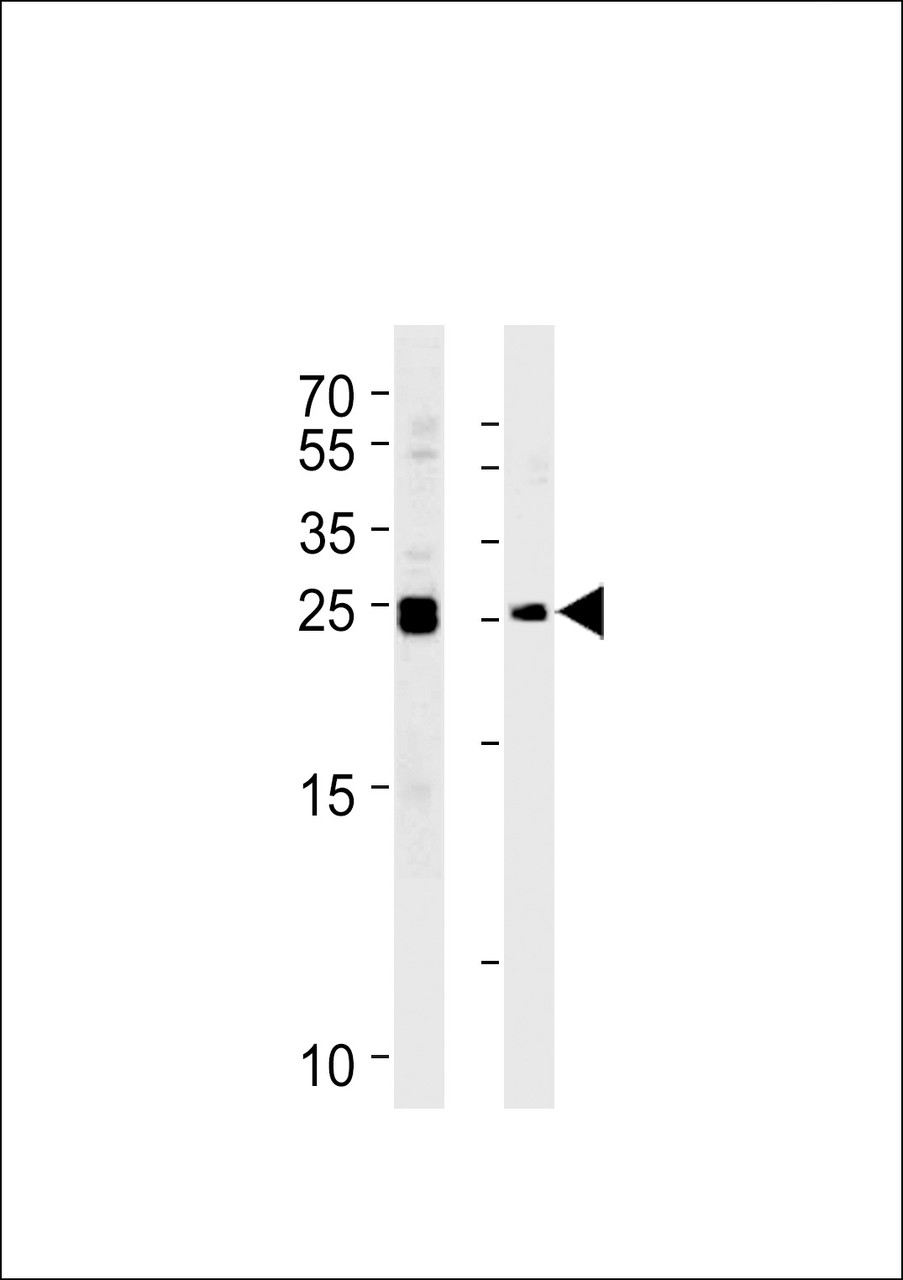 Western blot analysis in Daudi, K562 cell line lysates (35ug/lane) .