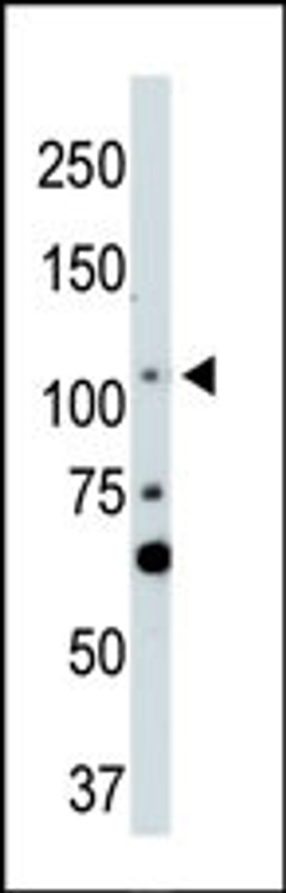 Antibody is used in Western blot to detect LATS2 in NIH-3T3 cell lysate.