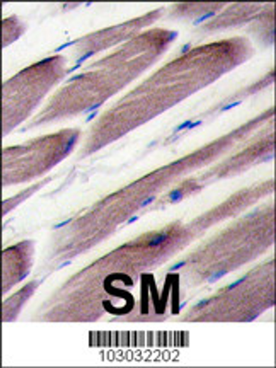 Formalin-fixed and paraffin-embedded human skeletal muscle tissue reacted with LATS2 antibody, which was peroxidase-conjugated to the secondary antibody, followed by DAB staining.