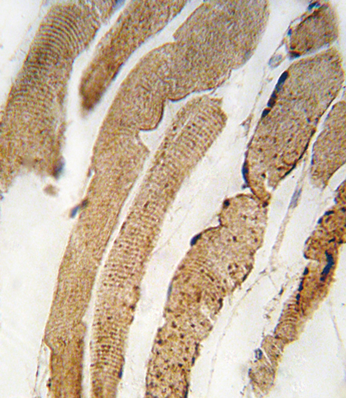 Formalin-fixed and paraffin-embedded human skeletal muscle tissue reacted with PDK4 antibody (Center D98) , which was peroxidase-conjugated to the secondary antibody, followed by DAB staining.