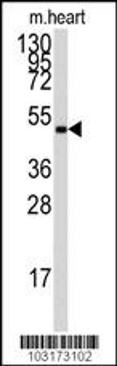 Antibody is used in Western blot to detect PRKAG1 in mouse heart tissue lysate.