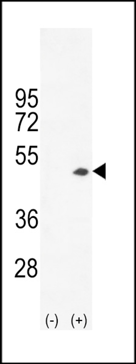 Western blot analysis of CKB using rabbit polyclonal CKB-C254 using 293 cell lysates (2 ug/lane) either nontransfected (Lane 1) or transiently transfected (Lane 2) with the CKB gene.