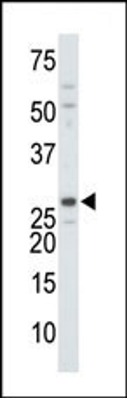 Antibody is used in Western blot to detect DTYMK in mouse colon tissue lysate.