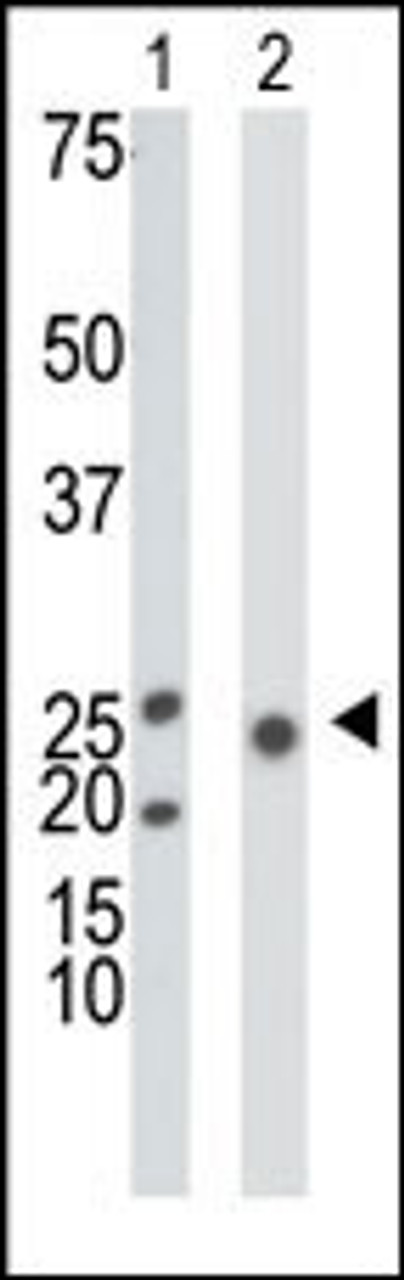 Antibody is used in Western blot to detect KHK in mouse liver tissue lysate (Lane 1) and 293 cell lysate (Lane 2) .