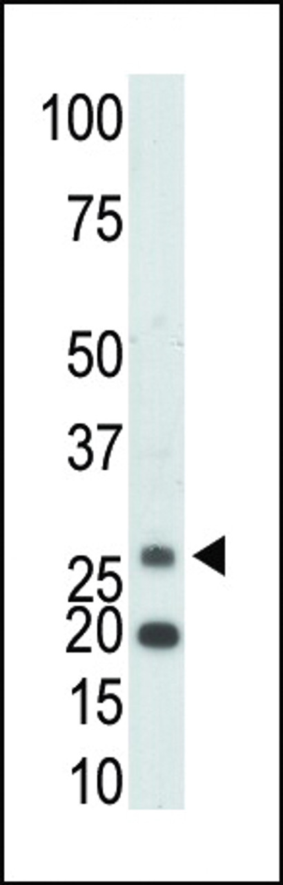 Antibody is used in Western blot to detect KHK in mouse kidney tissue lysate.