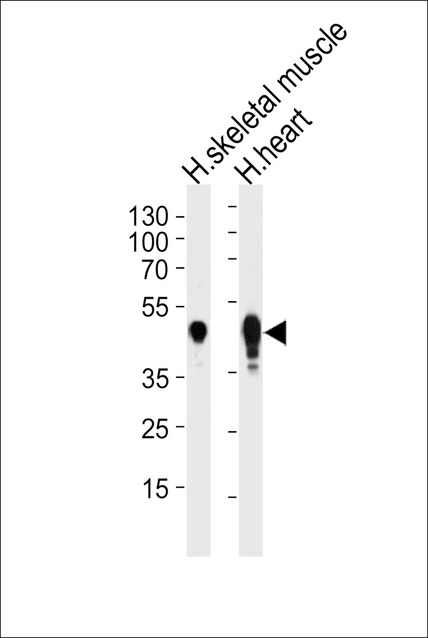 Western blot analysis of lysates from human skeletal muscle and heart tissue lysates (from left to right) , using CKMT2 Antibody (D406) at 1:1000 at each lane.
